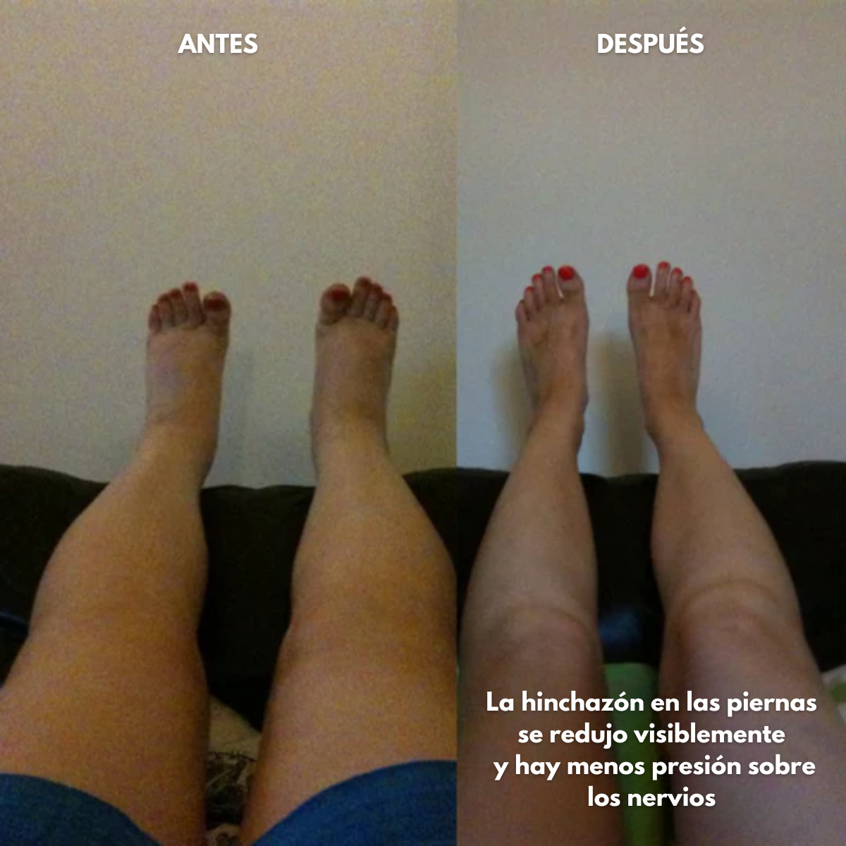 Blunttique™ - Loción Reparadora con Magnesio