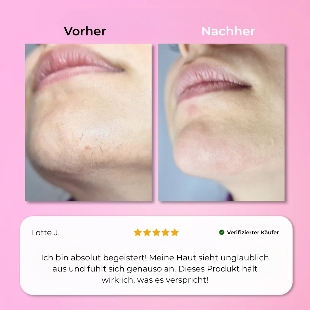 Aurlux™ – Instant Haarverwijderingskit