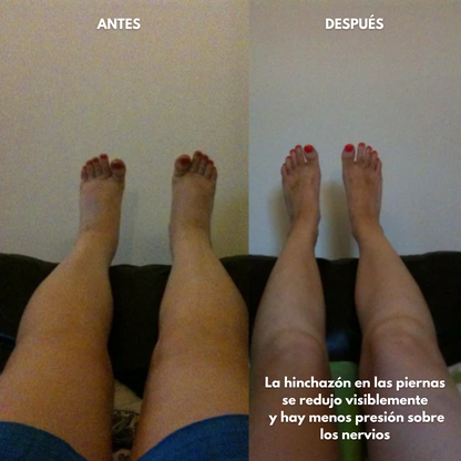 Blunttique™ - Loción Reparadora con Magnesio