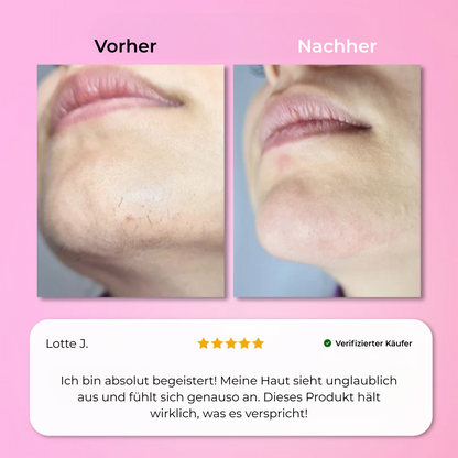 Aurlux™ – Instant Haarverwijderingskit