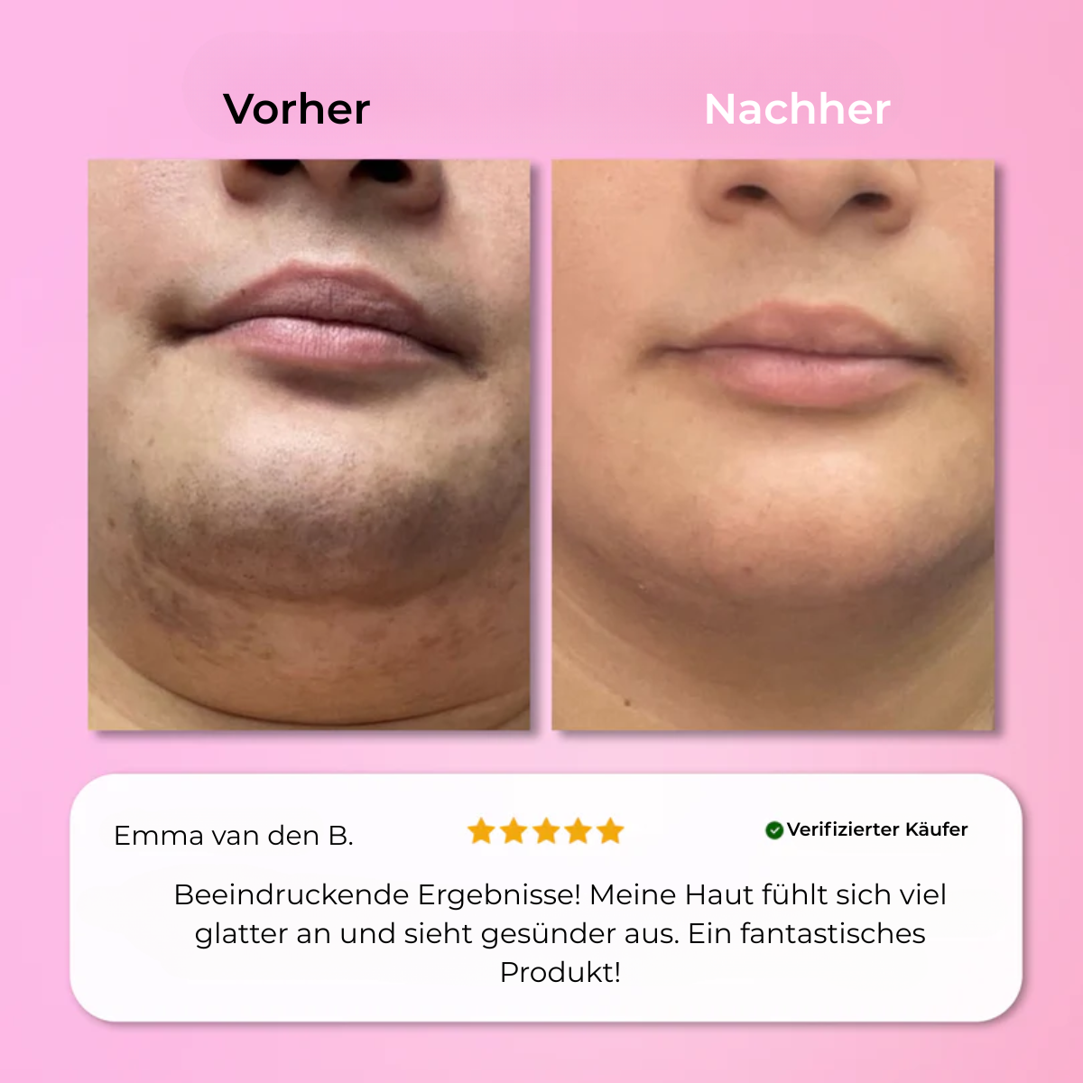 Aurlux™ – Instant Haarverwijderingskit