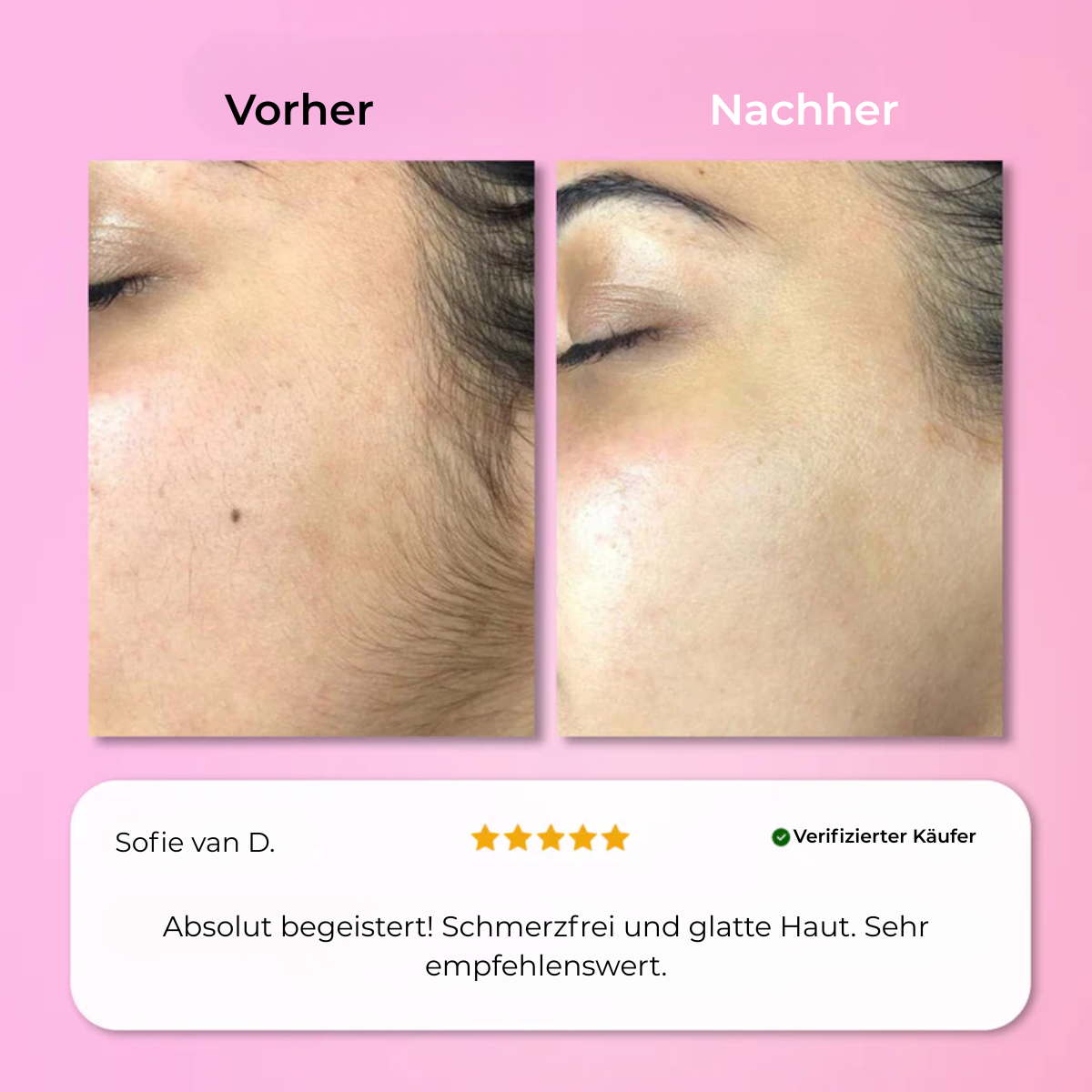 Aurlux™ – Instant Haarverwijderingskit