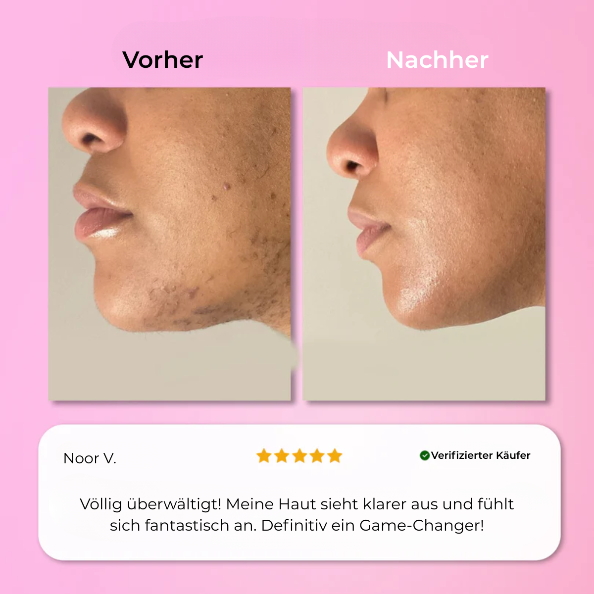 Aurlux™ – Instant Haarverwijderingskit