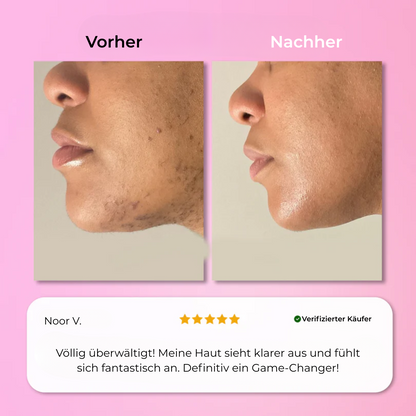 Aurlux™ – Instant Haarverwijderingskit