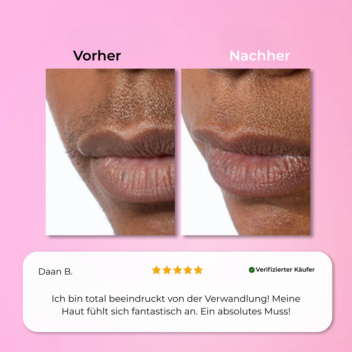 Aurlux™ – Instant Haarverwijderingskit