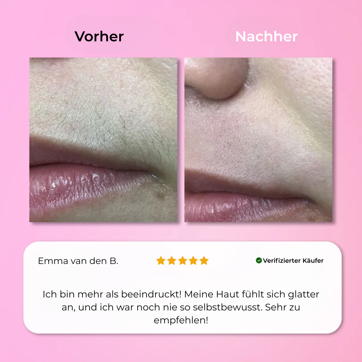 Aurlux™ – Instant Haarverwijderingskit