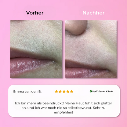 Aurlux™ – Instant Haarverwijderingskit